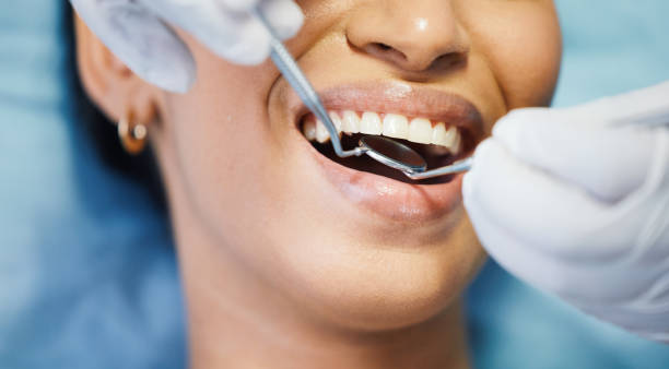 Best Same-Day Emergency Dental Services in Clover Creek, WA