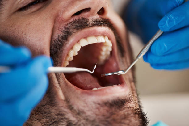 Best Cosmetic Emergency Dentistry in Clover Creek, WA